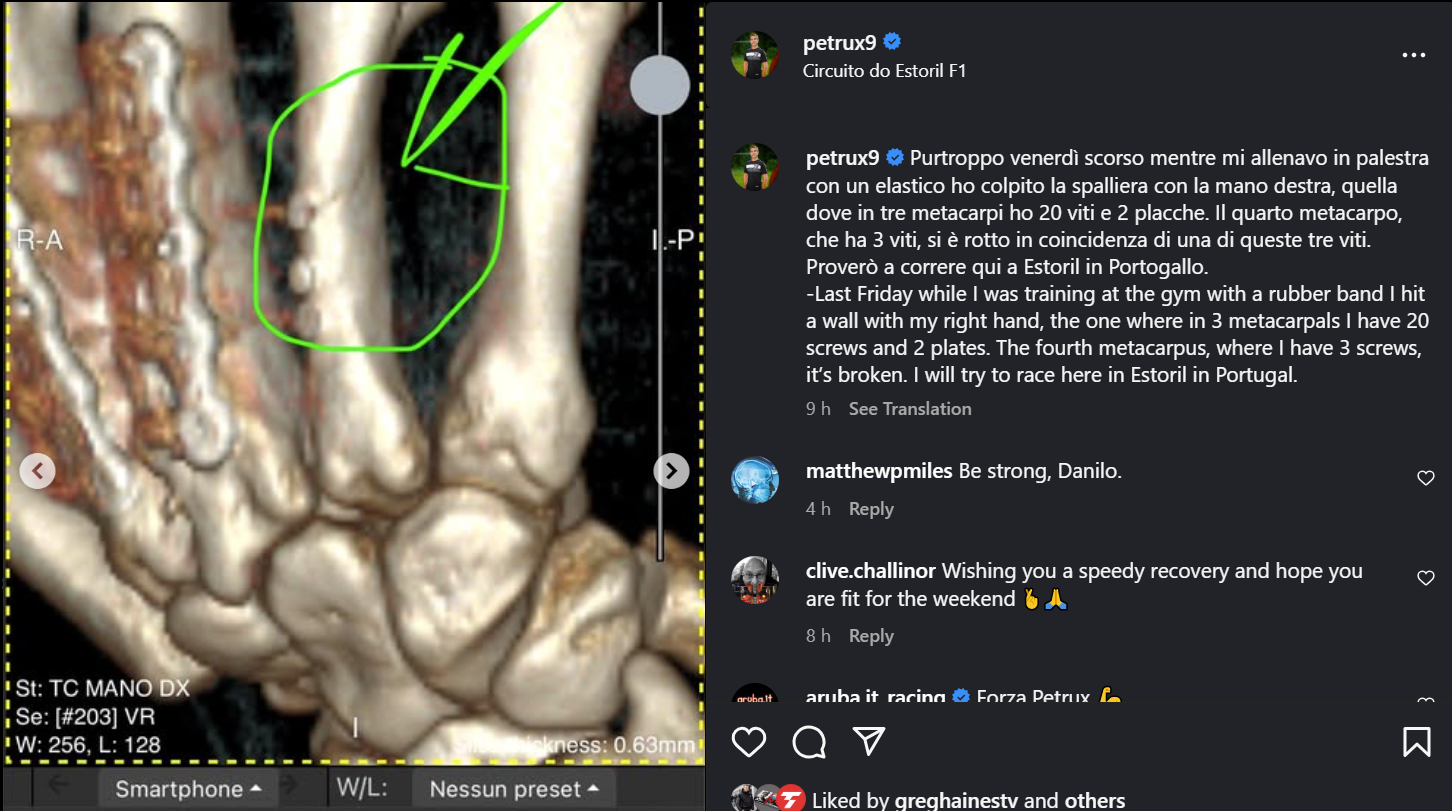 Danilo Petrucci hand injury (instagram)