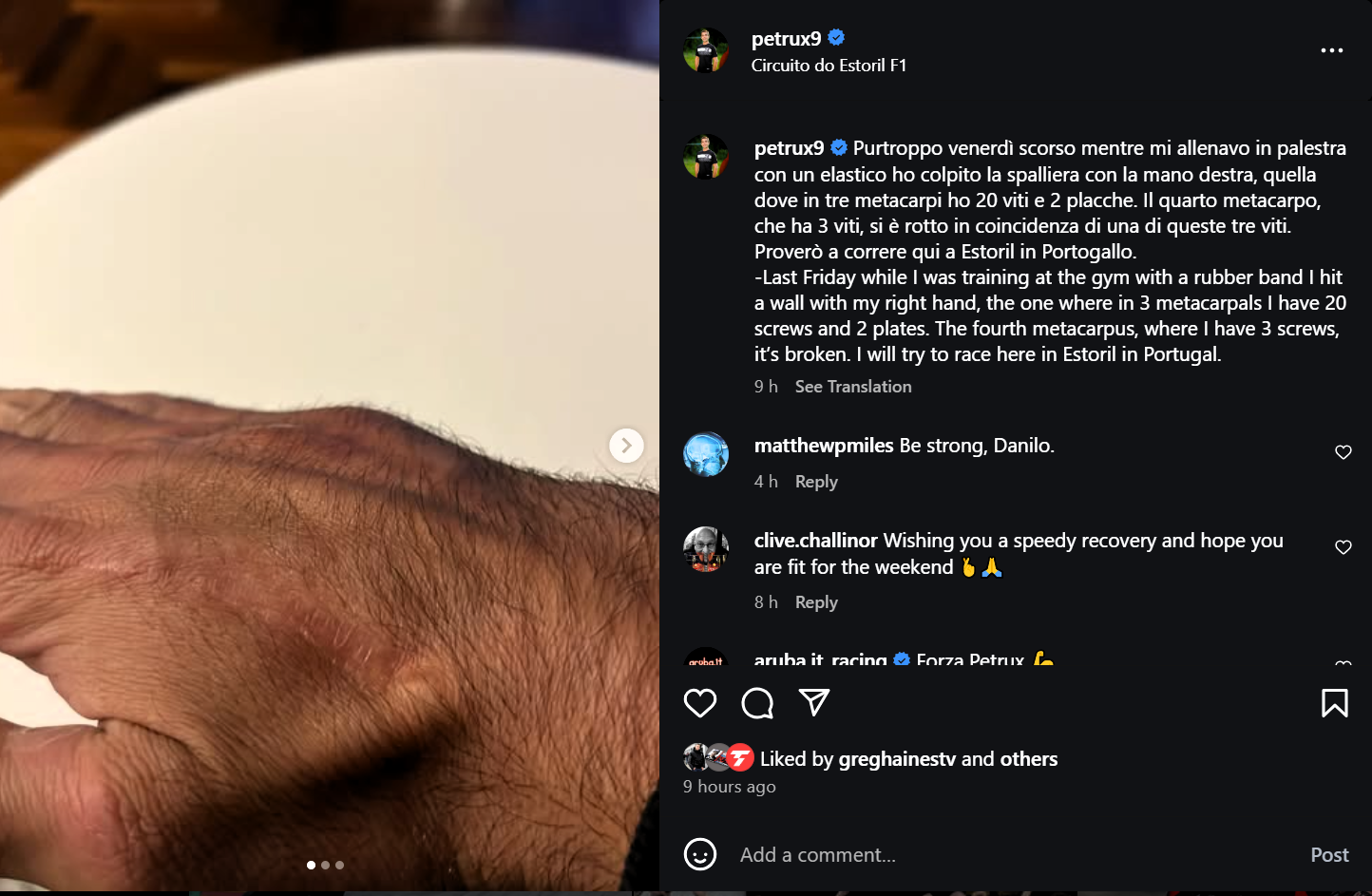Danilo Petrucci hand injury (instagram)