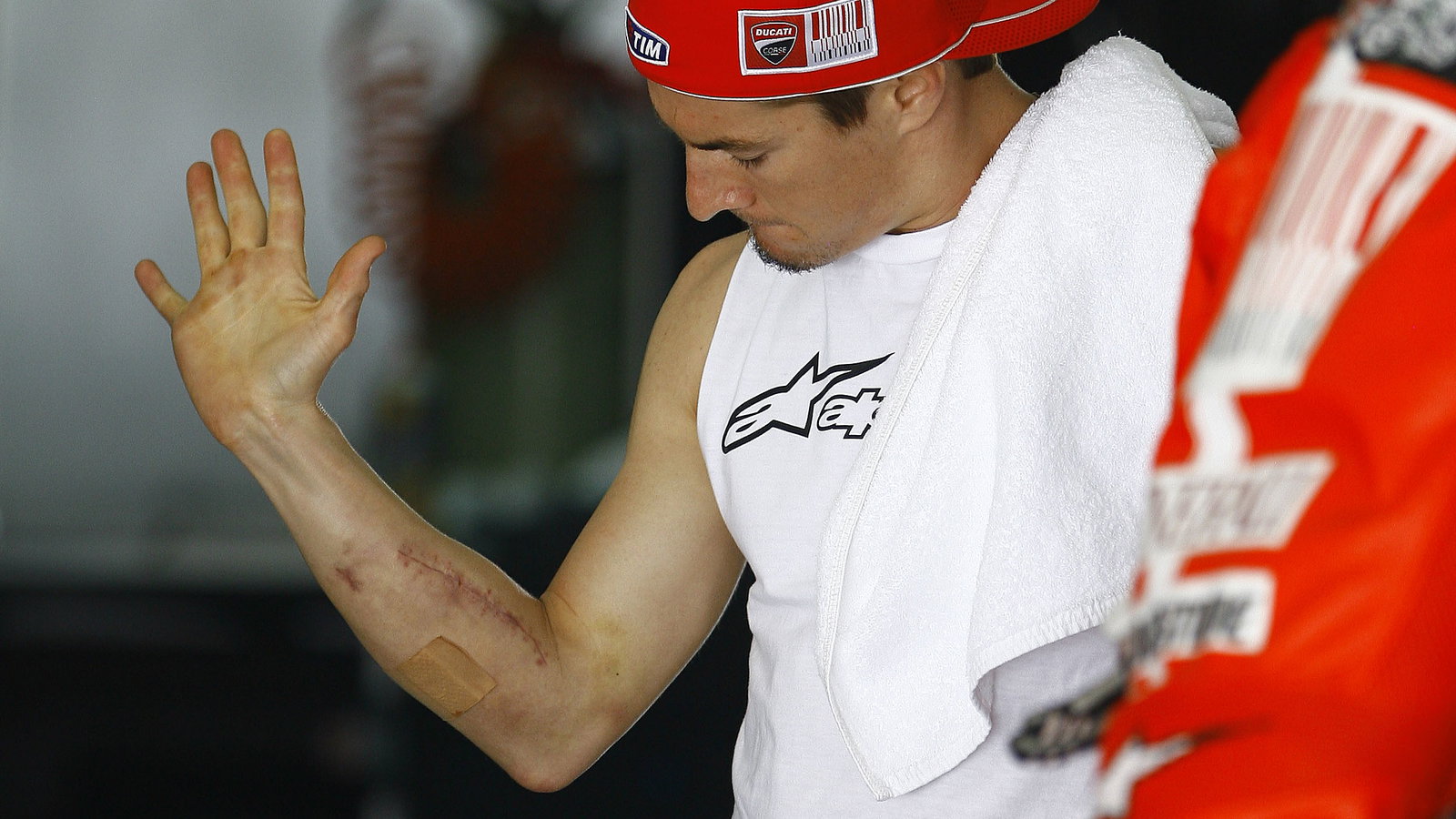 Hayden with post-operation scars, Sepang MotoGP tests, 25-26th February 2010