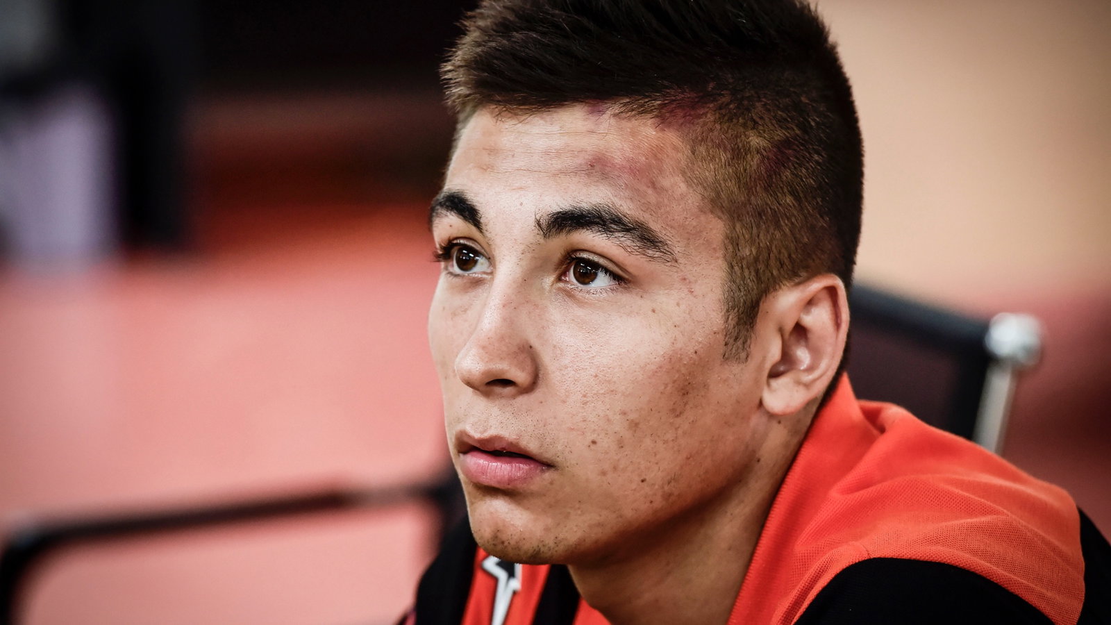 Raul Fernandez, Bruising on his head from a crash, MotoGP, Indonesian MotoGP test 12 February 2022