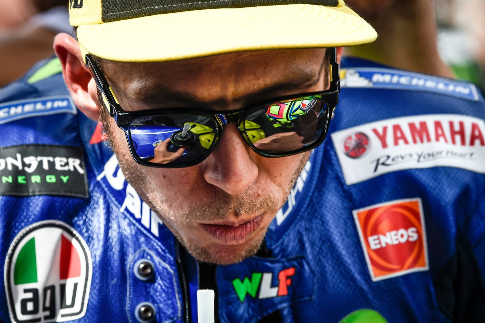 MotoGP: Rossi injuries confirmed, will undergo surgery 